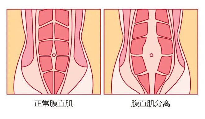 想产后恢复好、瘦的快这件事很重要很多人生半岛·BOB官方网站完几年还没做(图11)